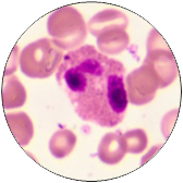 Transitional Epithelium