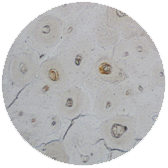 Transitional Epithelium