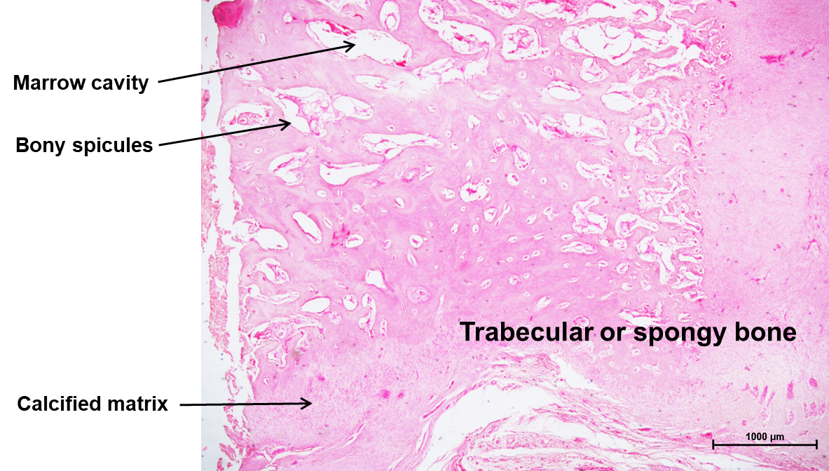 Bone