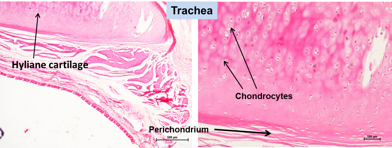 Hyaline cartilage