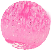Transitional Epithelium