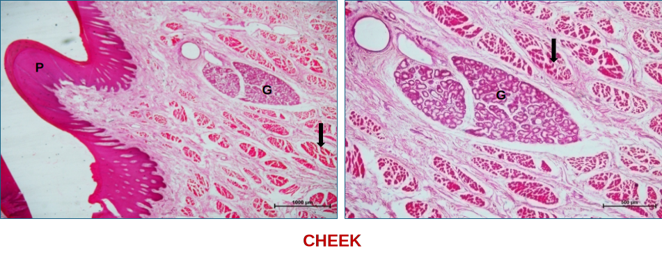 Cheek 2