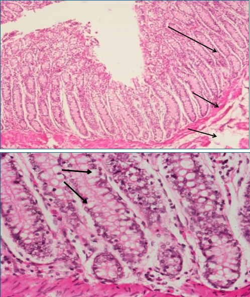 Large Intestine 1