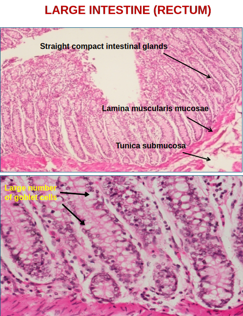 Large Intestine 2