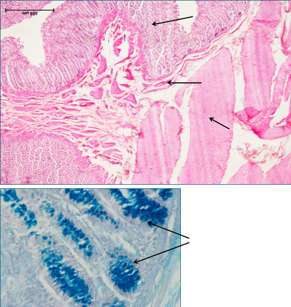 Large Intestine 3