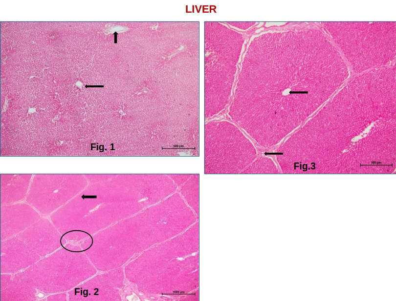Liver 1
