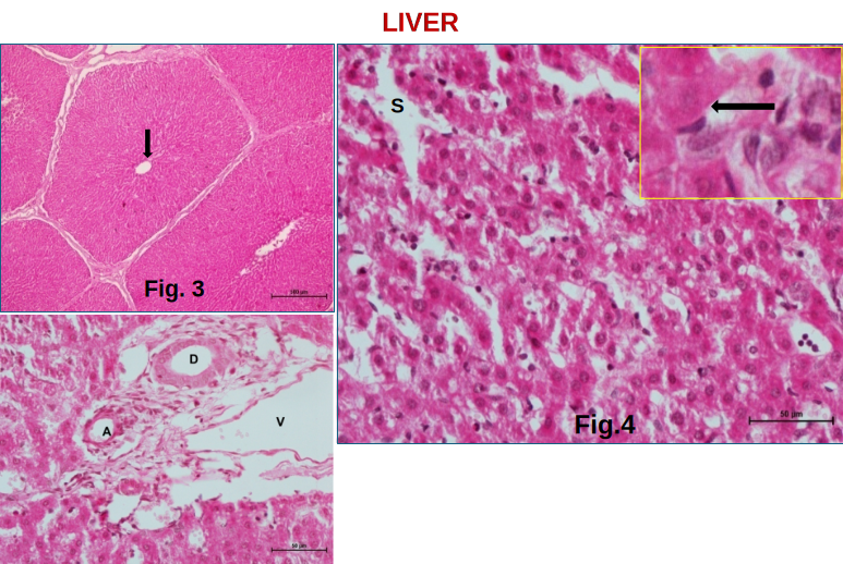 Liver 3