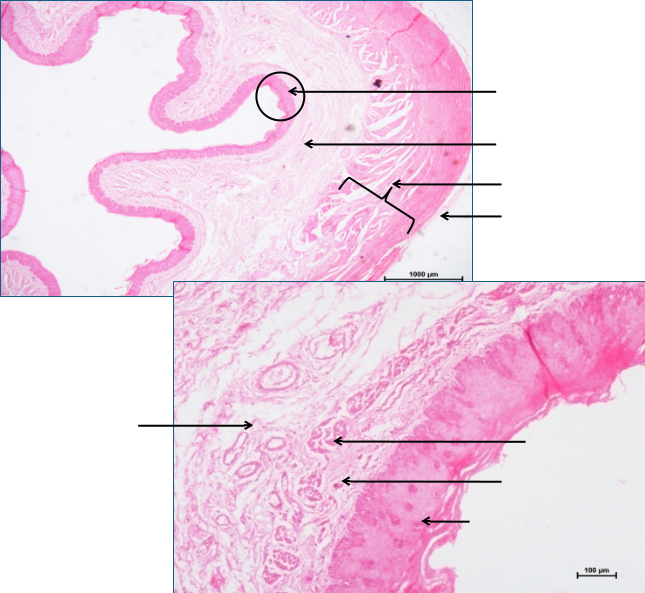 Oesophagus 1