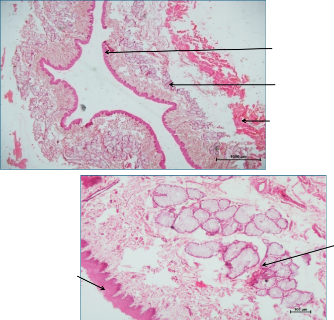 Oesophagus 3
