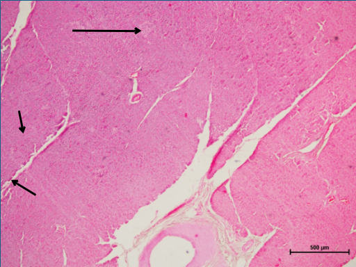 Pancreas 1