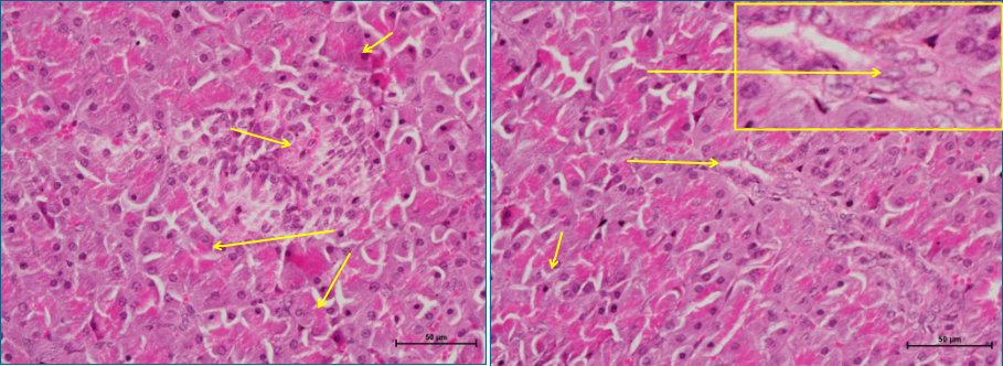 Pancreas 3