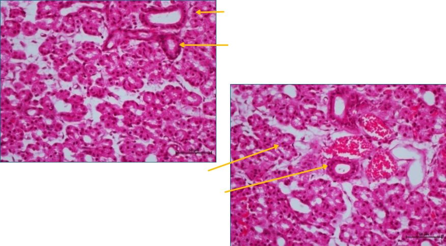 Salivary gland 1