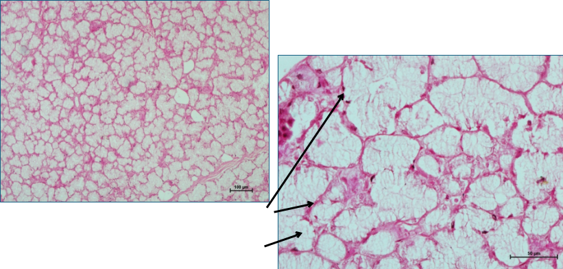 Salivary gland 3