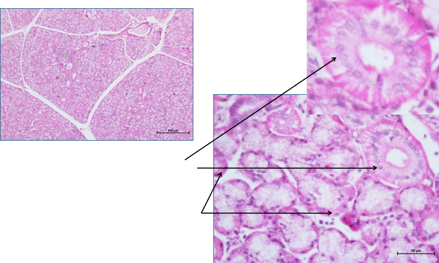 Salivary gland 5