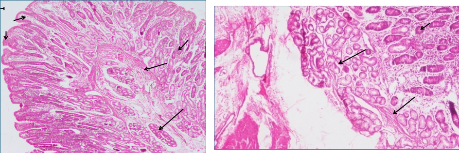 Small Intestine 1