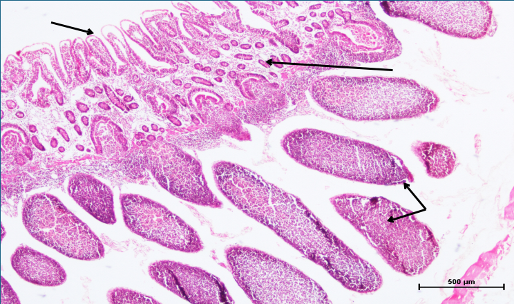 Small Intestine 3