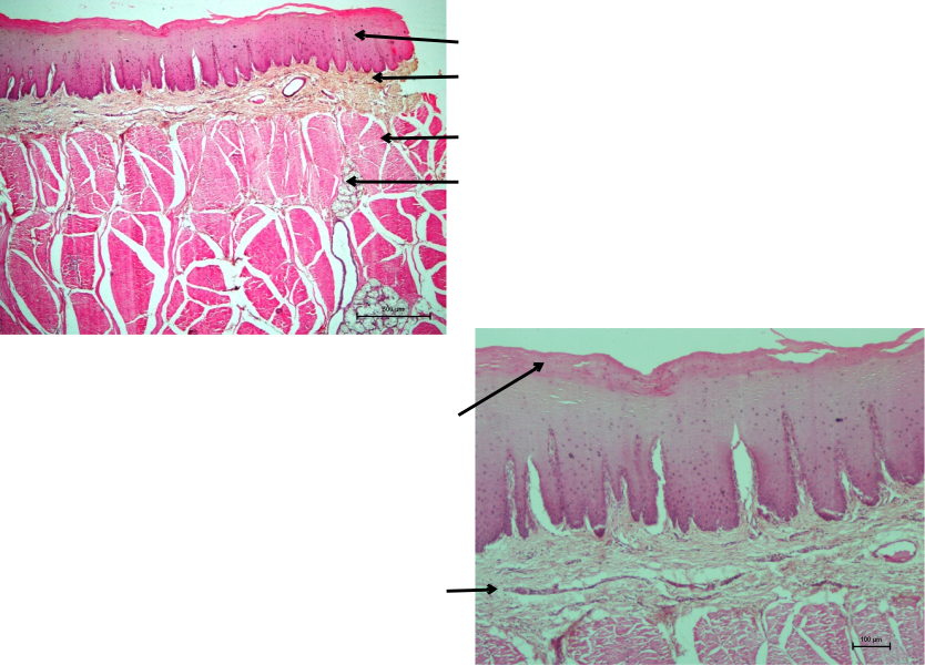 Tongue 1