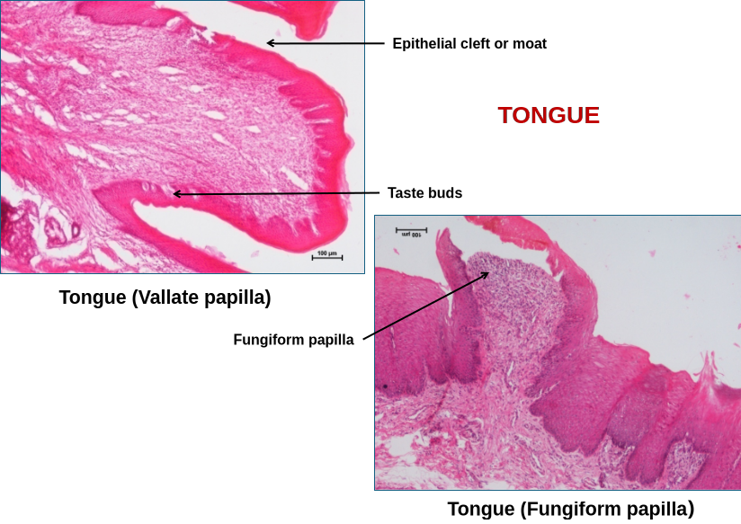 Tongue 6
