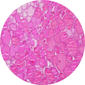 Thyroid Gland