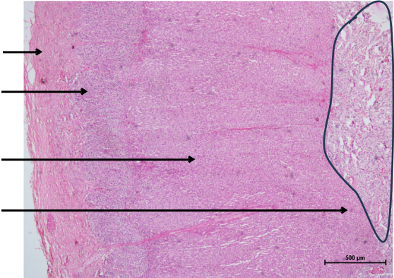Adrenal Gland 1