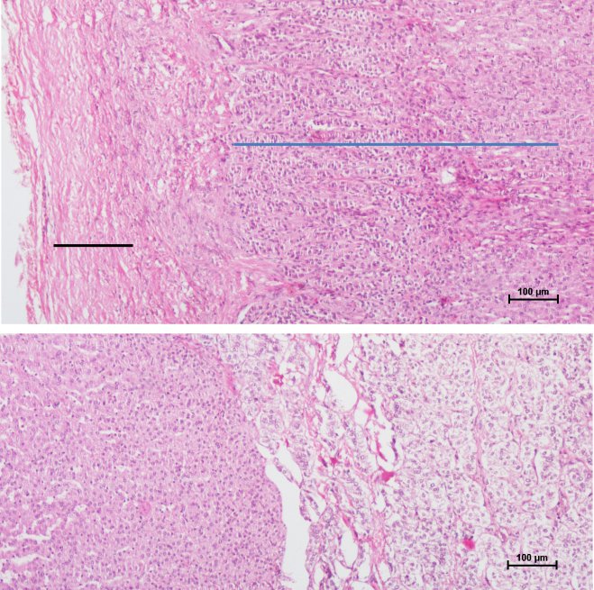 Adrenal Gland 3