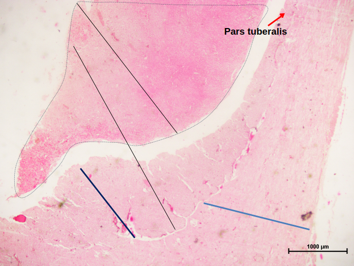 Pituitary Gland 1