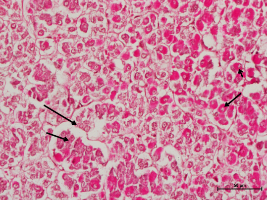 Pituitary Gland 3