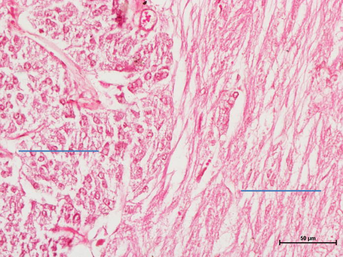 Pituitary Gland 5