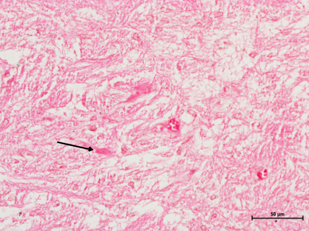Pituitary Gland 7