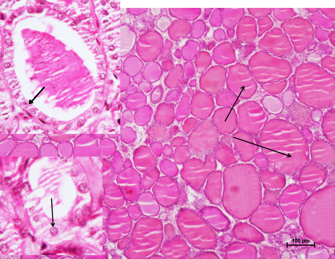 Thyroid Gland 1
