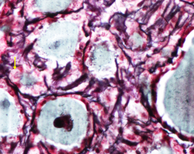 Thyroid Gland 3