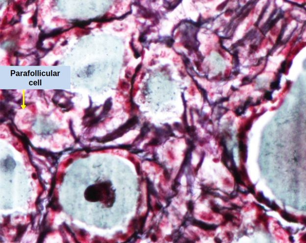 Thyroid Gland 4