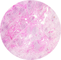Hemal Node