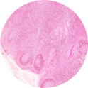 Lymph Node