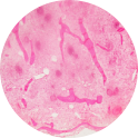 Spleen