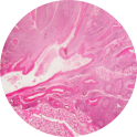 Tonsil
