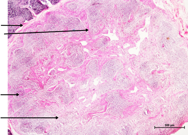 Hemal Node 1