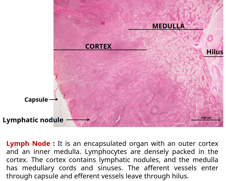 Lymph Node 2