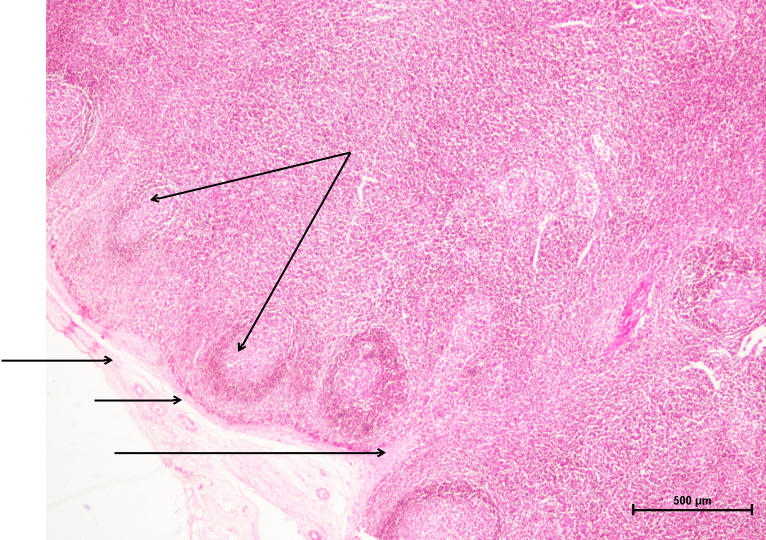 Lymph Node 3
