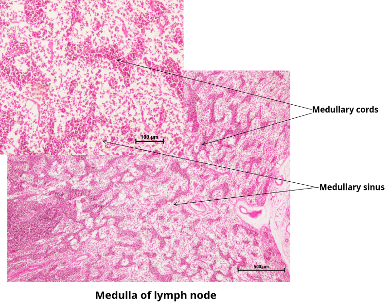 Lymph Node 6