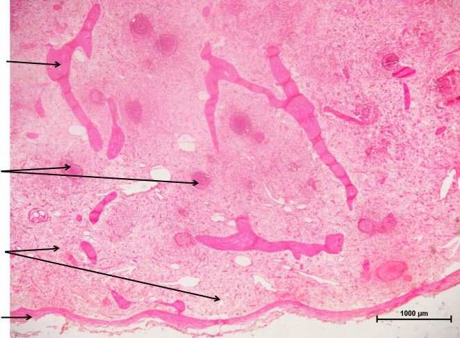 Spleen 1