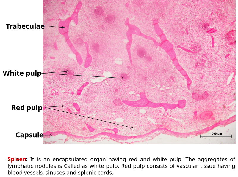 Spleen 2