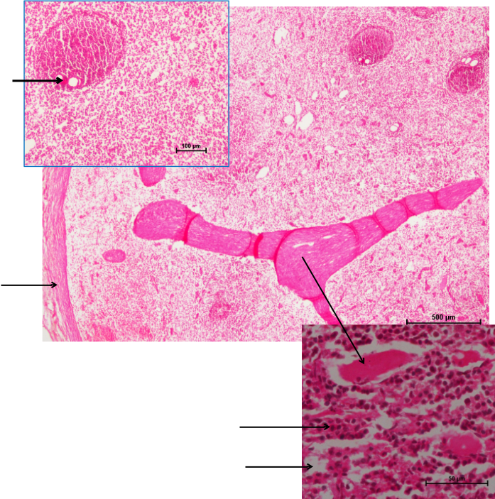 Spleen 3