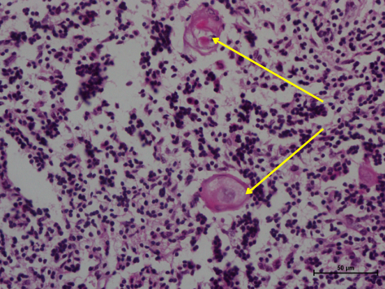 Thymus 3