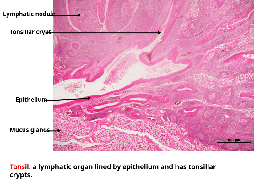 Tonsil 2