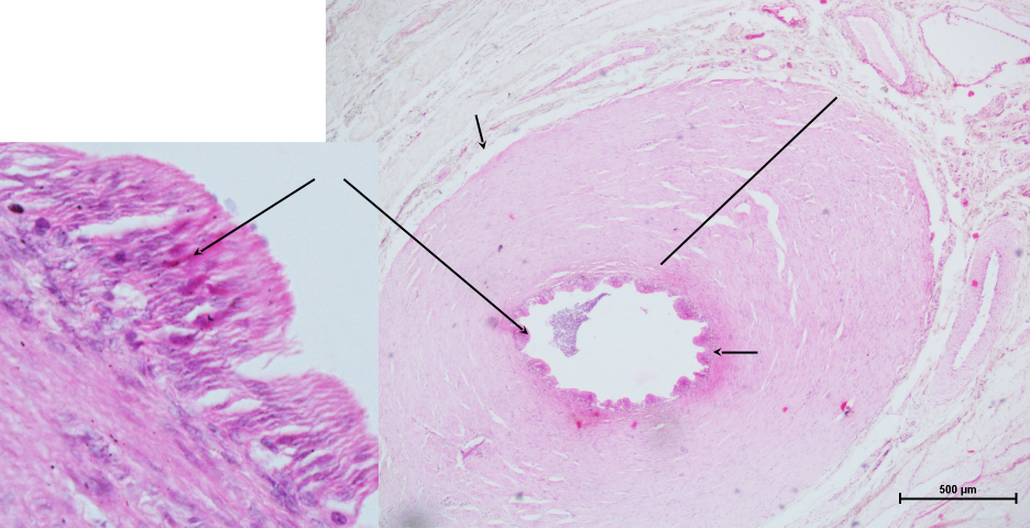 Ductus Deferens 1