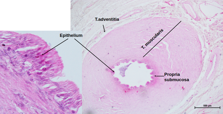 Ductus Deferens 2