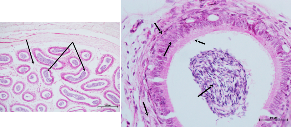 Epididymis 1