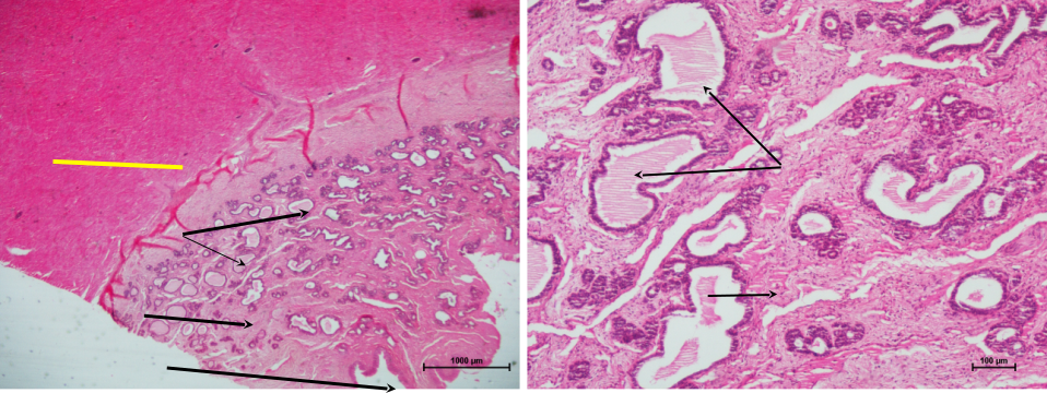 Prostate Gland 1
