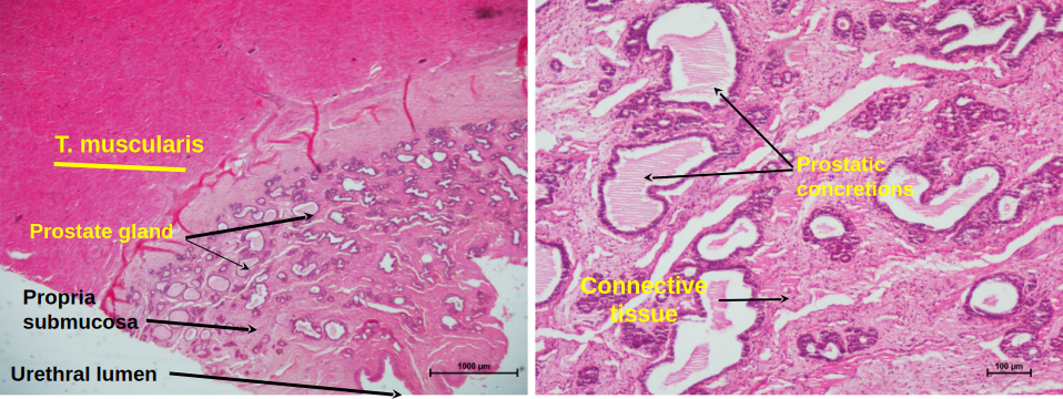 Prostate Gland 2